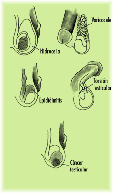 ls-testiculos