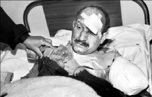 injured_iraqi_pol